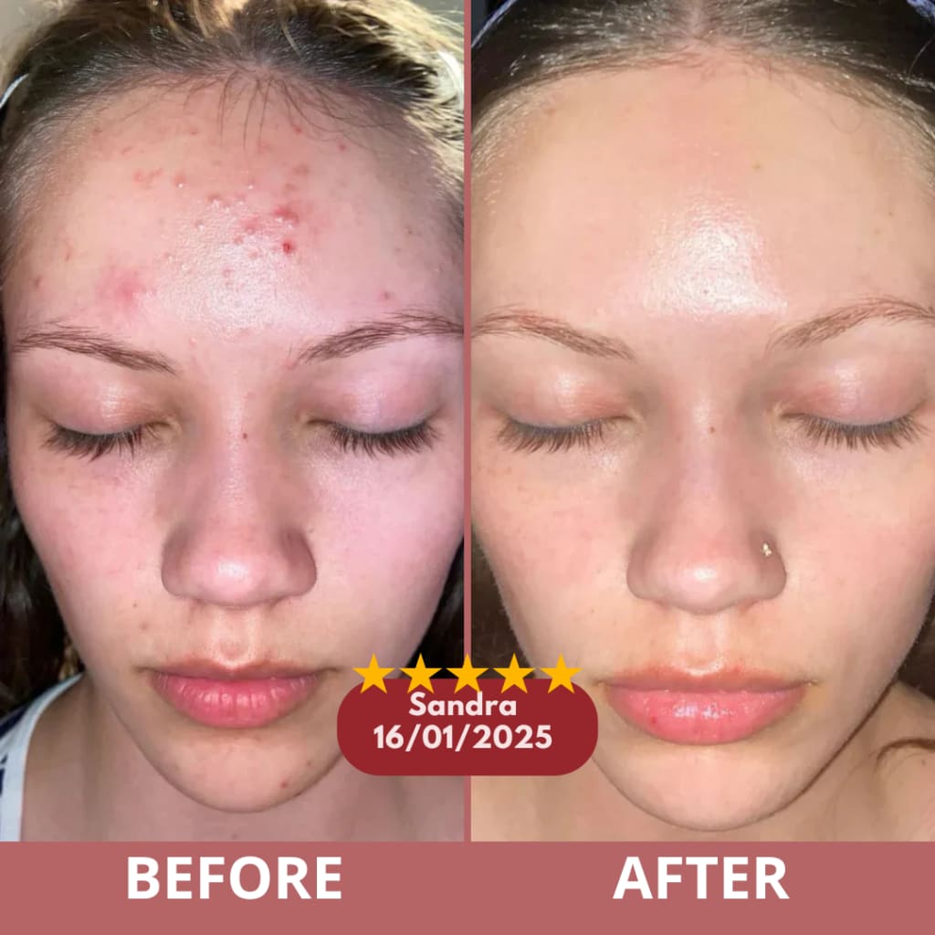 CocoBeauty Peel Shot Glow Rice Bundle