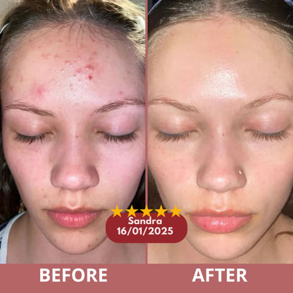 CocoBeauty Peel Shot Glow Rice Bundle