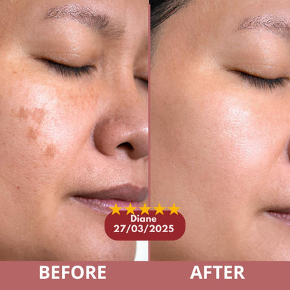 CocoBeauty Peel Shot Glow Rice Bundle